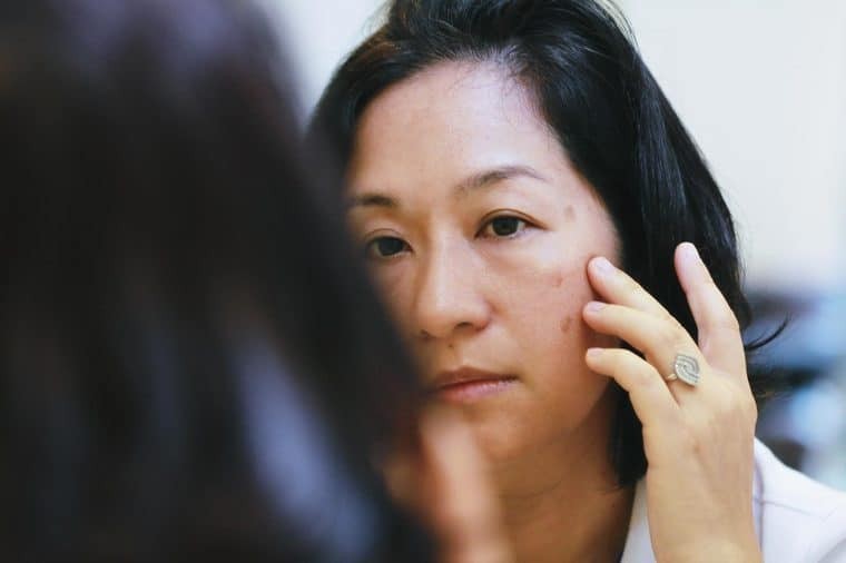 Phụ nữ đối mặt với nhiều vấn đề về da khi bước qua tuổi 35