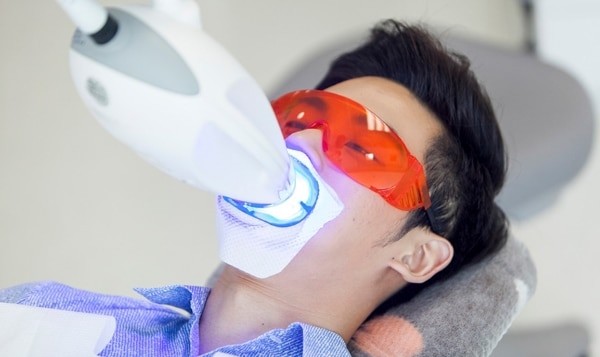 Tẩy trắng răng bằng laser có thể mang lại hiệu quả cao