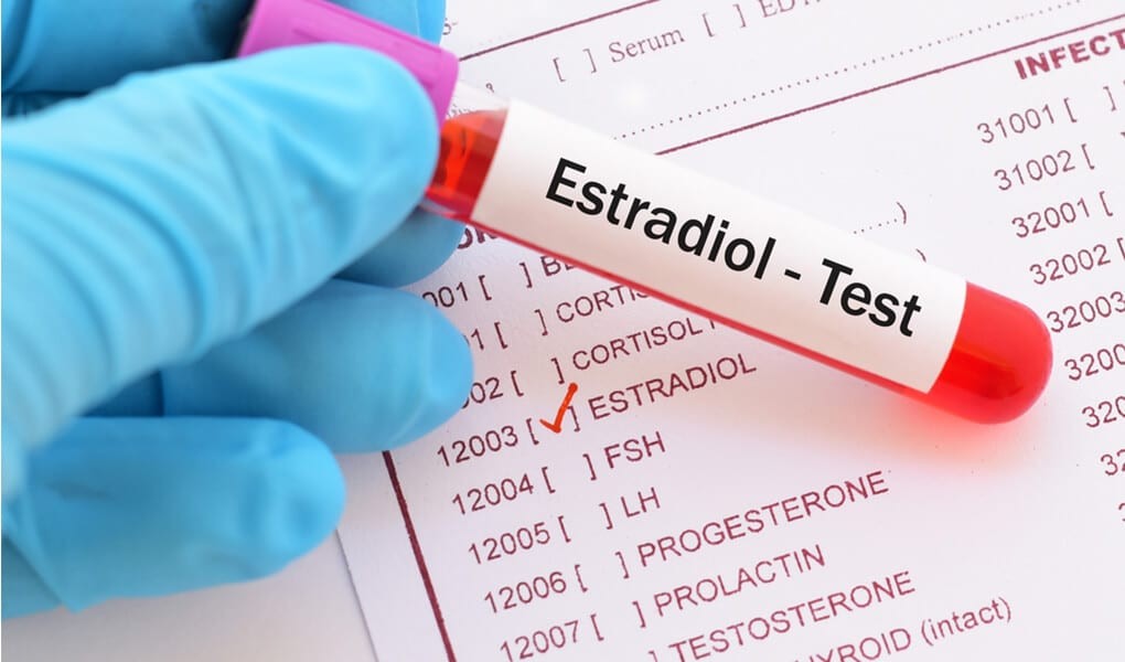 Xét nghiệm Estradiol thường được áp dụng trong chẩn đoán tình trạng thiếu hụt estrogen