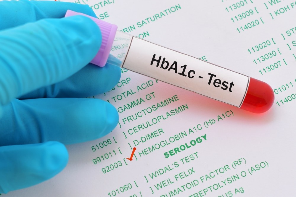 HbA1c được thực hiện ở phòng xét nghiệm