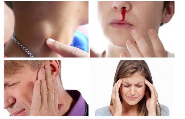 Các triệu chứng thường gặp trong ung thư vòm họng: hạch cổ, nghẹt hoặc chảy máu mũi, giảm thính lực hoặc ù tai, đau đầu,...