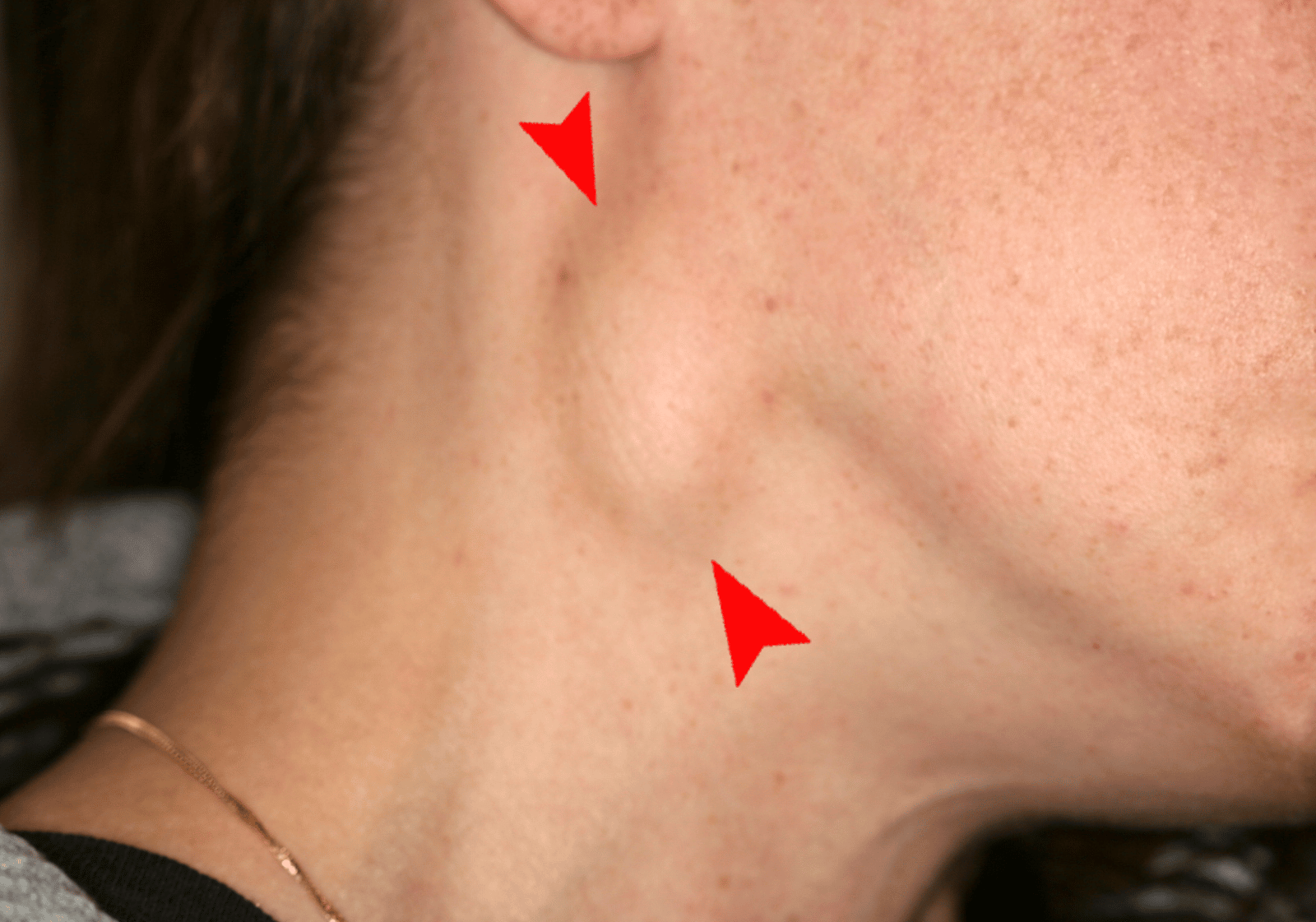 Cấu trúc giải phẫu vùng hầu họng và vị trí của vòm hầu