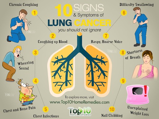 Một số triệu chứng có thể gặp của Ung thư phổi
