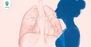 Dấu hiệu ung thư phổi ở nữ giới và nguyên nhân gây bệnh