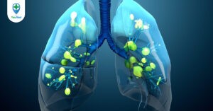 Nhiễm khuẩn đường hô hấp trên: nguyên nhân, triệu chứng, điều trị
