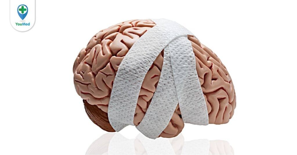 Chấn thương sọ não kín: nguyên nhân, triệu chứng và cách điều trị