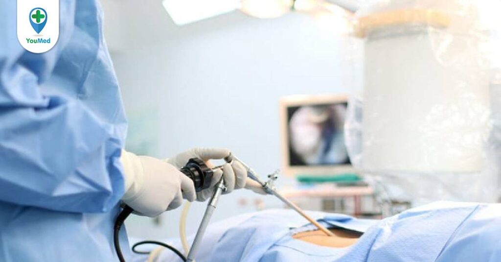 Các phương pháp mổ sỏi thận: ưu và nhược điểm của từng phương pháp