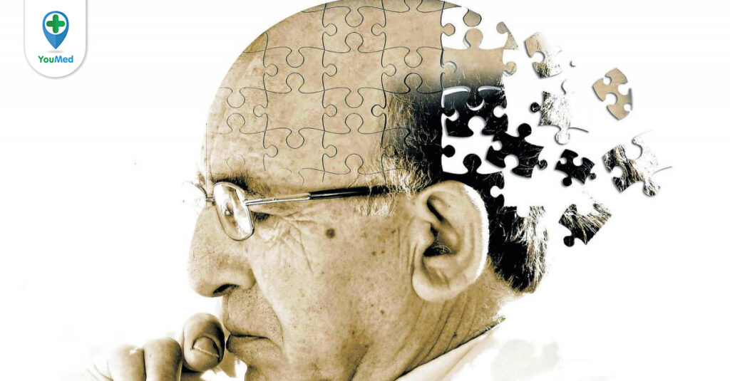 Teo não: Nguyên nhân, triệu chứng và cách điều trị