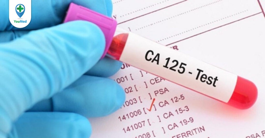 Xét nghiệm CA 125 là gì? Ý nghĩa chỉ số CA 125 đối với bệnh ung thư buồng trứng