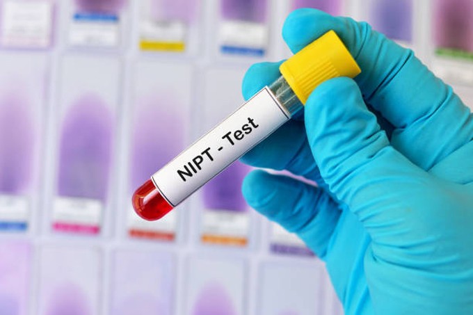 Xét nghiệm NIPT nhằm sàng lọc sớm những dị tật bẩm sinh của thai nhi