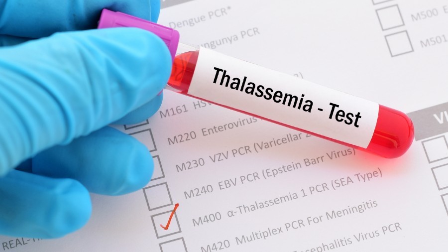 Nên tìm hiểu kỹ về xét nghiệm Thalassemia trước khi thực hiện