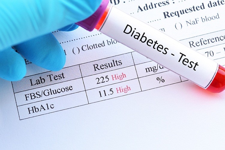 Tùy vào phương pháp xét nghiệm mà giá xét nghiệm tiểu đường sẽ khác nhau