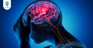 Xuất huyết não: Nguyên nhân, dấu hiệu, cách điều trị