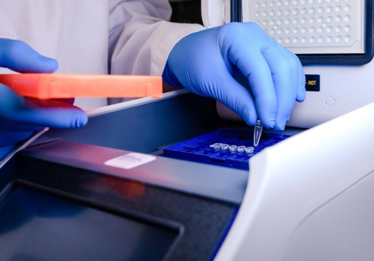 Xét nghiệm PCR yêu cầu kỹ thuật cao