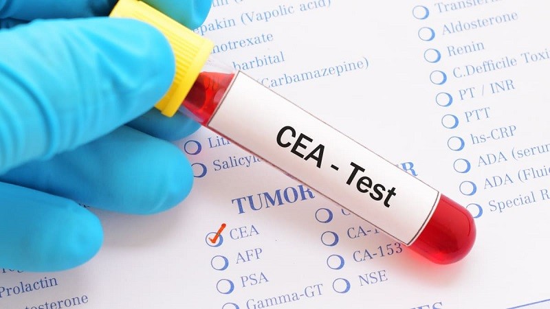 Xét nghiệm CEA thường được chỉ định trong theo dõi đáp ựng điều trị ung thư đường tiêu hóa.