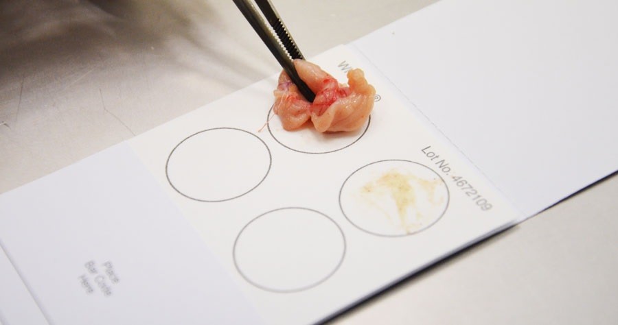 Thẻ thu mẫu xét nghiệm ADN qua máu chứa giấy FTA
