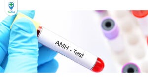 Xét nghiệm AMH là gì và cách đọc kết quả xét nghiệm