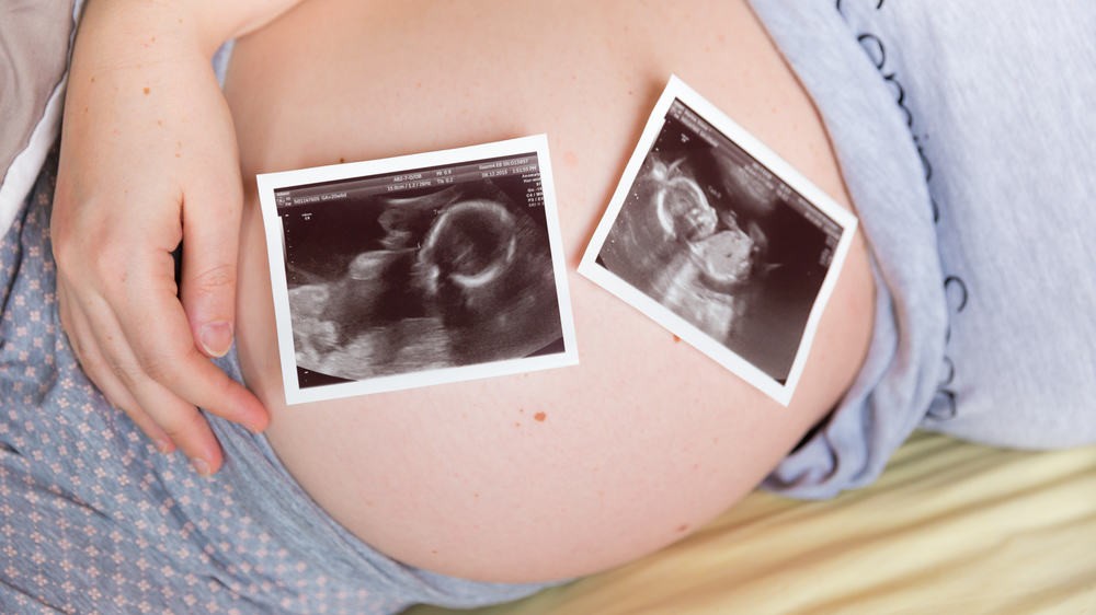 Tình trạng đa thai có thể khiến nồng độ hCG cao hơn mức bình thường