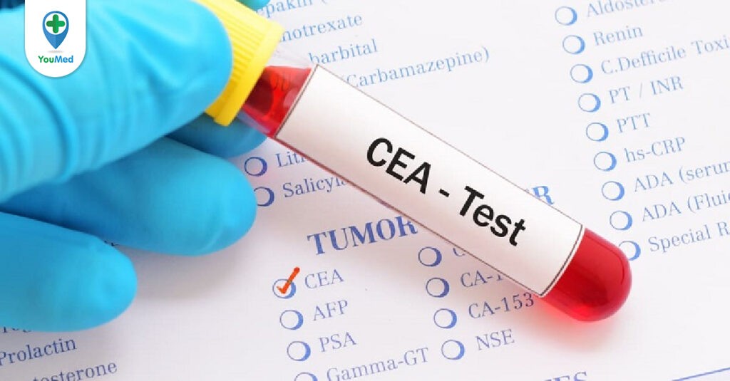 Xét nghiệm CEA là gì và cách đọc kết quả xét nghiệm