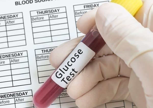 Xét nghiệm glucose để giúp chẩn đoán bệnh tiểu đường