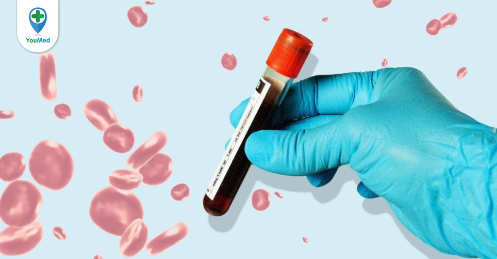 Xét nghiệm máu là gì? Ý nghĩa các loại xét nghiệm máu