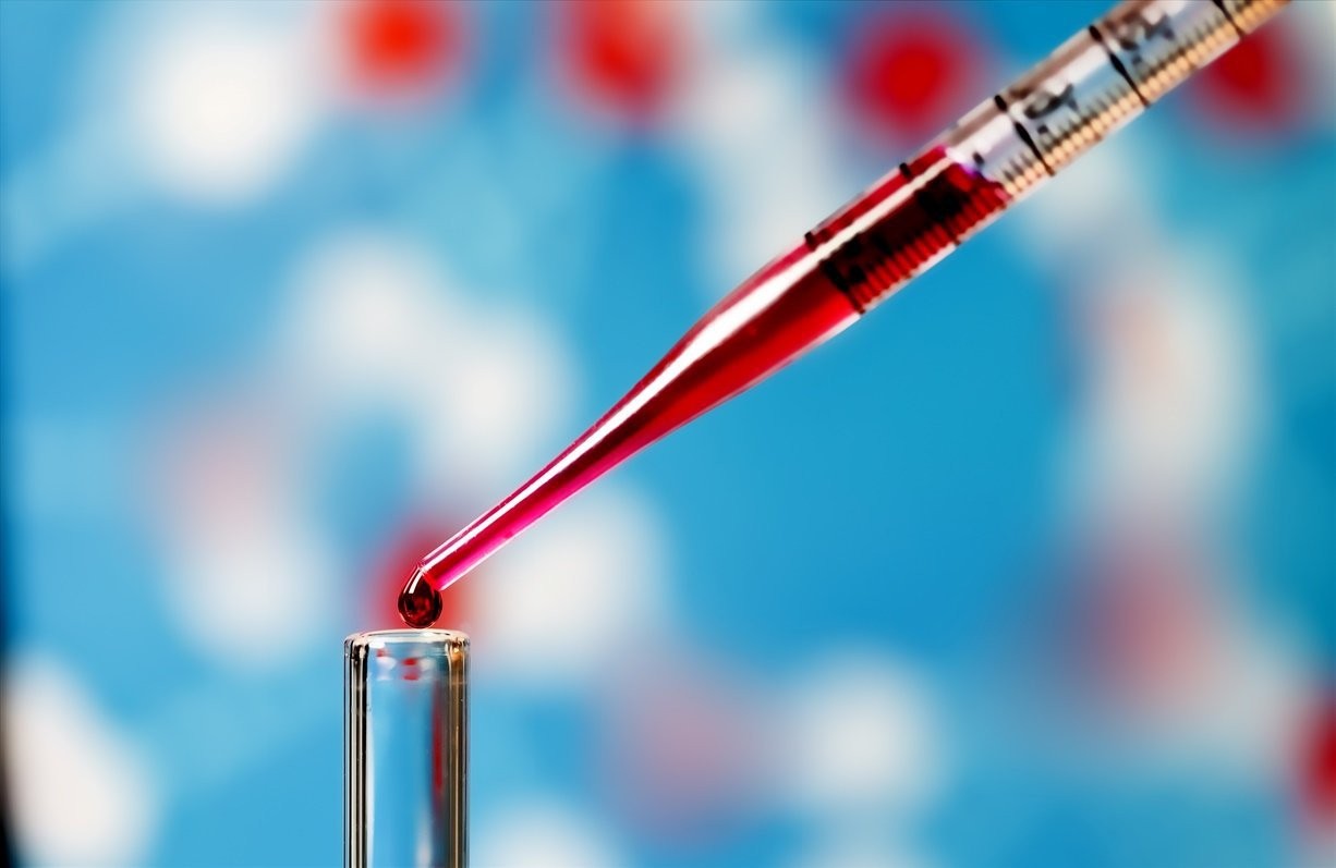 Xét nghiệm máu có vai trò đánh giá sức khỏe tổng quan và phát hiện những vấn đề bất thường của cơ thể