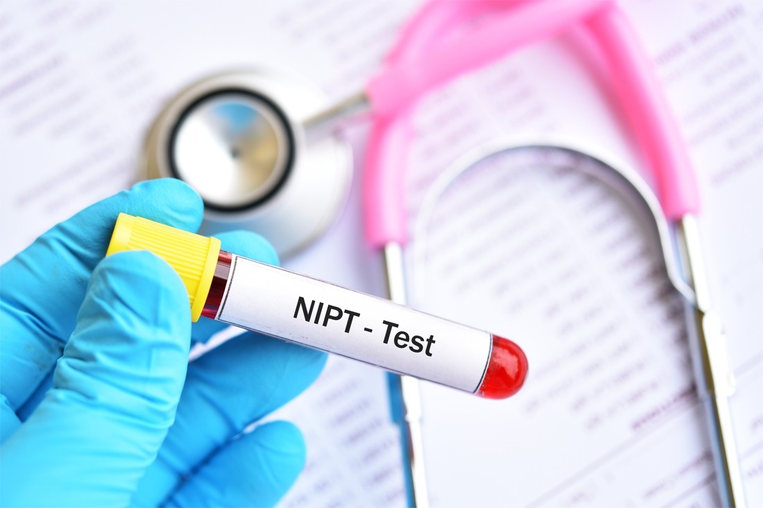 Nhiễm sắc thể đồ và NIPT là các xét nghiệm nhiễm sắc thể phổ biến hiện nay