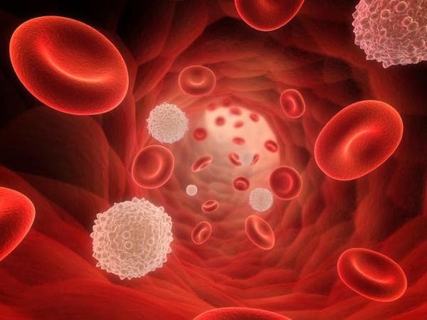 Số lượng bạch cầu tăng lên ở người bệnh ung thư máu