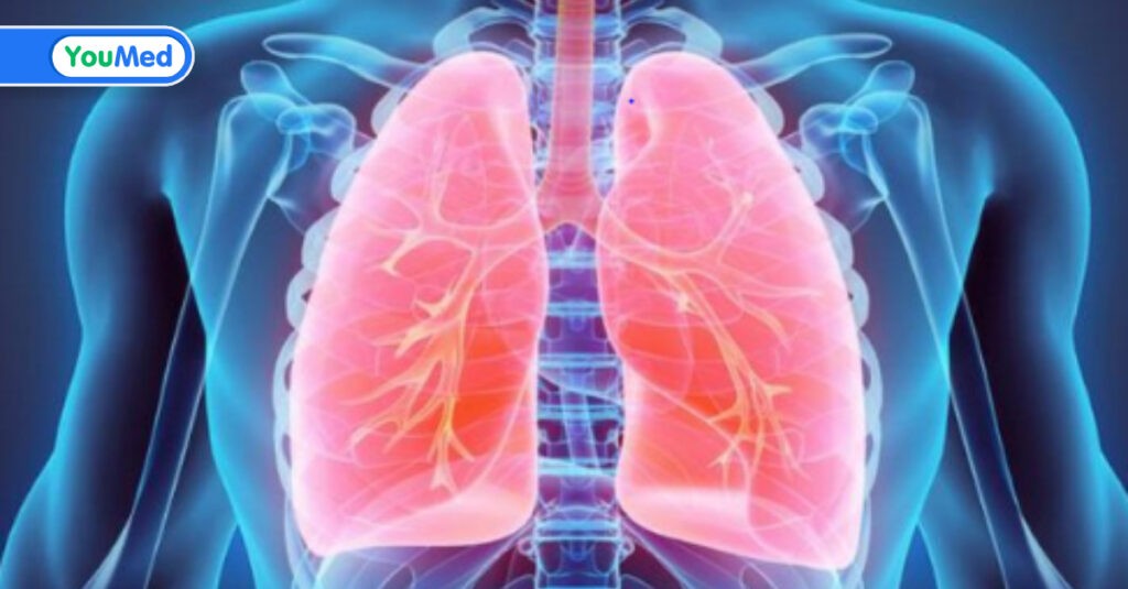 Bệnh viêm phổi là gì? Nguyên nhân, triệu chứng và cách chữa trị